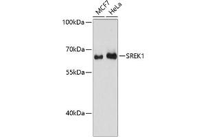 Western blot analysis of extracts of various cell lines, using SREK1 antibody (ABIN6132836, ABIN6148434, ABIN6148435 and ABIN6217160) at 1:3000 dilution. (SFRS12 antibody  (AA 1-180))