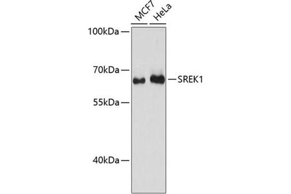 SFRS12 Antikörper  (AA 1-180)