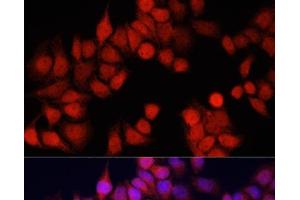 Immunofluorescence analysis of HeLa cells using CSTB Polyclonal Antibody at dilution of 1:100. (CSTB antibody)