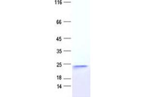 Validation with Western Blot (TNNC2 Protein (DYKDDDDK Tag))