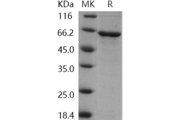 CDKL2 Protein (His tag)