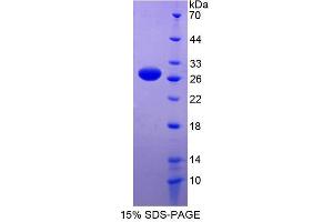Image no. 1 for RNA Binding Motif Protein 38 (RBM38) (AA 25-207) protein (His tag) (ABIN6237178) (RBM38 Protein (AA 25-207) (His tag))