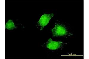 Immunofluorescence of monoclonal antibody to EDC4 on HeLa cell. (EDC4 antibody  (AA 1302-1401))