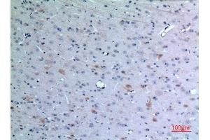 Immunohistochemistry (IHC) analysis of paraffin-embedded Rat Brain, antibody was diluted at 1:100. (CCL26 antibody  (Internal Region))