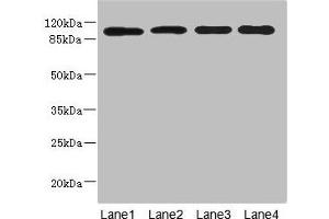 Western blot All lanes: USP26 antibody at 5. (USP26 antibody  (AA 664-913))