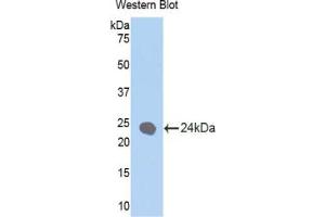 Western blot analysis of the recombinant protein. (Cytokeratin 1 antibody  (AA 350-488))