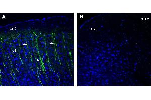 Expression of Prostaglandin E Receptor EP3 in mouse parietal cortex.