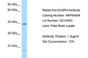 Western Blotting (WB) image for anti-Dual Specificity Phosphatase 4 (DUSP4) (N-Term) antibody (ABIN2789727) (DUSP4 antibody  (N-Term))