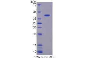 Image no. 1 for Centrosomal Protein 55kDa (CEP55) (AA 189-464) protein (His tag) (ABIN5665148) (CEP55 Protein (AA 189-464) (His tag))