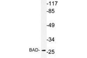 Western blot analysis of BAD antibody in extracts from NIH/3T3 cells. (BAD antibody)