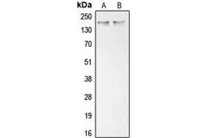 Western blot analysis of Collagen 11 alpha 1 expression in K562 (A), Saos2 (B) whole cell lysates. (COL11A1 antibody  (Center))