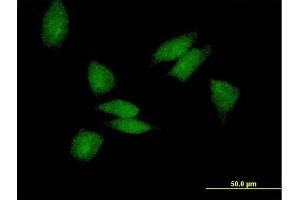 Immunofluorescence of purified MaxPab antibody to PABPC3 on HeLa cell. (PABPC3 antibody  (AA 1-631))