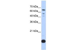 Thioredoxin 2 antibody used at 1 ug/ml to detect target protein. (TXN2 antibody  (Middle Region))