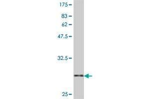 Western Blot detection against Immunogen (31. (Selenoprotein K antibody  (AA 39-91))