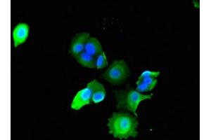 Immunofluorescent analysis of MCF-7 cells using ABIN7142898 at dilution of 1:100 and Alexa Fluor 488-congugated AffiniPure Goat Anti-Rabbit IgG(H+L) (ADAMTS9 antibody  (AA 1276-1506))