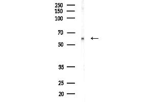anti-Prolyl 4-Hydroxylase, alpha Polypeptide I (P4HA1) (N-Term) antibody