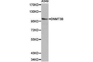 Western Blotting (WB) image for anti-DNA (Cytosine-5-)-Methyltransferase 3 beta (DNMT3B) antibody (ABIN1872328)