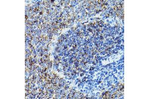 Immunohistochemistry of paraffin-embedded rat spleen using CD79B Rabbit pAb (ABIN3022745, ABIN3022746, ABIN3022747 and ABIN6219206) at dilution of 1:100 (40x lens). (CD79b antibody  (AA 29-159))