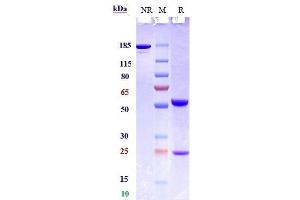 Anti-Siglec-2 / CD22 Reference Antibody (NCI m971) on SDS-PAGE under reducing (R) condition.