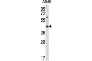 Western Blotting (WB) image for anti-Olfactory Receptor, Family 51, Subfamily S, Member 1 (OR51S1) antibody (ABIN2996656) (OR51S1 antibody)