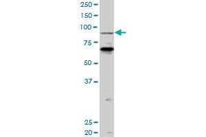 PCAF monoclonal antibody (M04), clone 5E11. (KAT2B antibody  (AA 353-452))