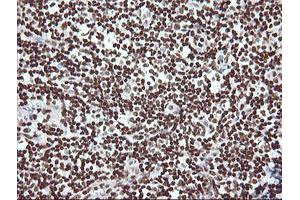 Image no. 9 for anti-THUMP Domain Containing 1 (THUMPD1) antibody (ABIN1501384) (THUMPD1 antibody)