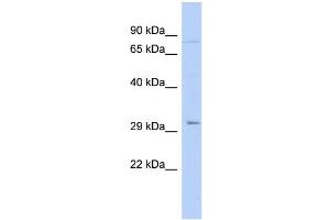 WB Suggested Anti-PITX2 Antibody Titration:  0. (PITX2 antibody  (N-Term))