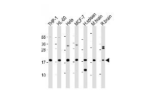 All lanes : Anti-ARPC5 Antibody (Center) at 1:2000 dilution Lane 1: THP-1 whole cell lysate Lane 2: HL-60 whole cell lysate Lane 3: Hela whole cell lysate Lane 4: MCF-7 whole cell lysate Lane 5: Human spleen lysate Lane 6: Mouse brain lysate Lane 7: Rat brain lysate Lysates/proteins at 20 μg per lane. (ARPC5 antibody  (AA 67-101))