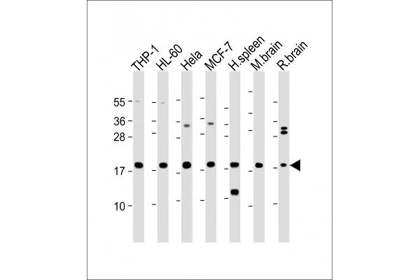 ARPC5 antibody  (AA 67-101)