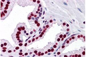 Human Prostate: Formalin-Fixed, Paraffin-Embedded (FFPE) (SMAD6 antibody  (AA 285-385))