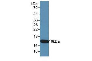 Detection of Recombinant KRT15, Human using Monoclonal Antibody to Cytokeratin 15 (CK15) (KRT15 antibody  (AA 274-399))