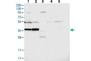Western blot analysis of Lane 1: RT-4, Lane 2: U-251 MG, Lane 3: Human Plasma, Lane 4: Liver, Lane 5: Tonsil with PRUNE2 polyclonal antibody  at 1:250-1:500 dilution. (PRUNE2 antibody)