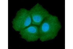 ICC/IF analysis of ADSL in Hep3B cells line, stained with DAPI (Blue) for nucleus staining and monoclonal anti-human ADSL antibody (1:100) with goat anti-mouse IgG-Alexa fluor 488 conjugate (Green). (Adenylosuccinate Lyase antibody)