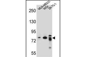 ARHG Antibody (C-term) (ABIN656937 and ABIN2846128) western blot analysis in MDA-M,WiDr,ZR-75-1 cell line lysates (35 μg/lane). (ARHGAP22 antibody  (C-Term))
