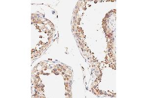 Immunohistochemical analysis of paraffin-embedded human testis tissue using B performed on the Leica® BOND RXm. (DLL3 antibody  (C-Term))