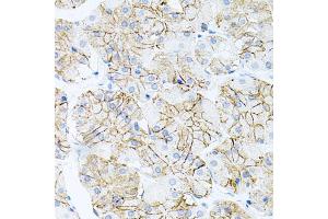 Immunohistochemistry of paraffin-embedded human stomach using IL17A antibody (ABIN6290529) at dilution of 1:100 (40x lens). (Interleukin 17a antibody)