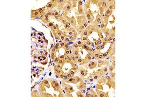 (ABIN6242522 and ABIN6577190) staining PGK1 in human kidney tissue sections by Immunohistochemistry (IHC-P - paraformaldehyde-fixed, paraffin-embedded sections). (PGK1 antibody  (AA 1-417))