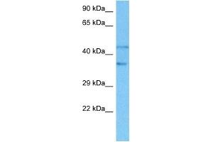 Host:  Rat  Target Name:  SMAD2  Sample Tissue:  Rat Liver  Antibody Dilution:  1ug/ml (SMAD2 antibody  (N-Term))