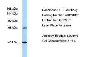 Western Blotting (WB) image for anti-Epidermal Growth Factor Receptor (EGFR) (Middle Region) antibody (ABIN2788648) (EGFR antibody  (Middle Region))