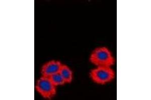 Immunofluorescent analysis of CPI17 staining in Jurkat cells. (CPI-17 antibody  (N-Term))