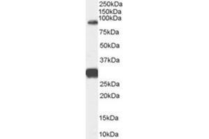 Image no. 1 for anti-Forkhead Box P2 (FOXP2) (Internal Region) antibody (ABIN375200) (FOXP2 antibody  (Internal Region))