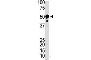 Western blot testing of SUV39H2 antibody and mouse kidney tissue lysate (SUV39H2 antibody  (AA 93-122))