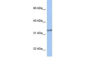 ACBD4 antibody used at 1 ug/ml to detect target protein. (ACBD4 antibody  (N-Term))