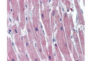 Immunohistochemistry (IHC) image for anti-Cardiac Troponin I (TNNI3) (Middle Region) antibody (ABIN2776782)
