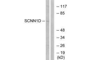 Western blot analysis of extracts from RAW264. (SCNN1D antibody)