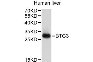 Western blot analysis of extracts of human liver, using BTG3 antibody (ABIN3048296). (BTG3 antibody)