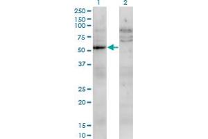 Western Blot analysis of UMPS expression in transfected 293T cell line by UMPS monoclonal antibody (M05), clone 2F5. (UMPS antibody  (AA 381-479))