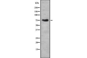 Western blot analysis of THOC1 using COLO205 whole cell lysates (THOC1 antibody  (C-Term))