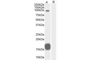 Western Blotting (WB) image for anti-rho GTPase Activating Protein 26 (ARHGAP26) (C-Term) antibody (ABIN2465789) (GRAF antibody  (C-Term))
