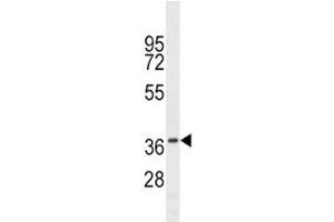NKX6. (NKX6-1 antibody  (AA 285-314))